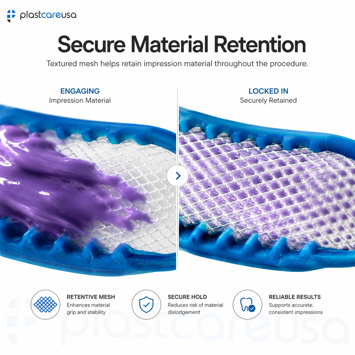 1000 x Posterior Blue Bite Registration Impression Trays (20 Boxes) by PlastCare USA