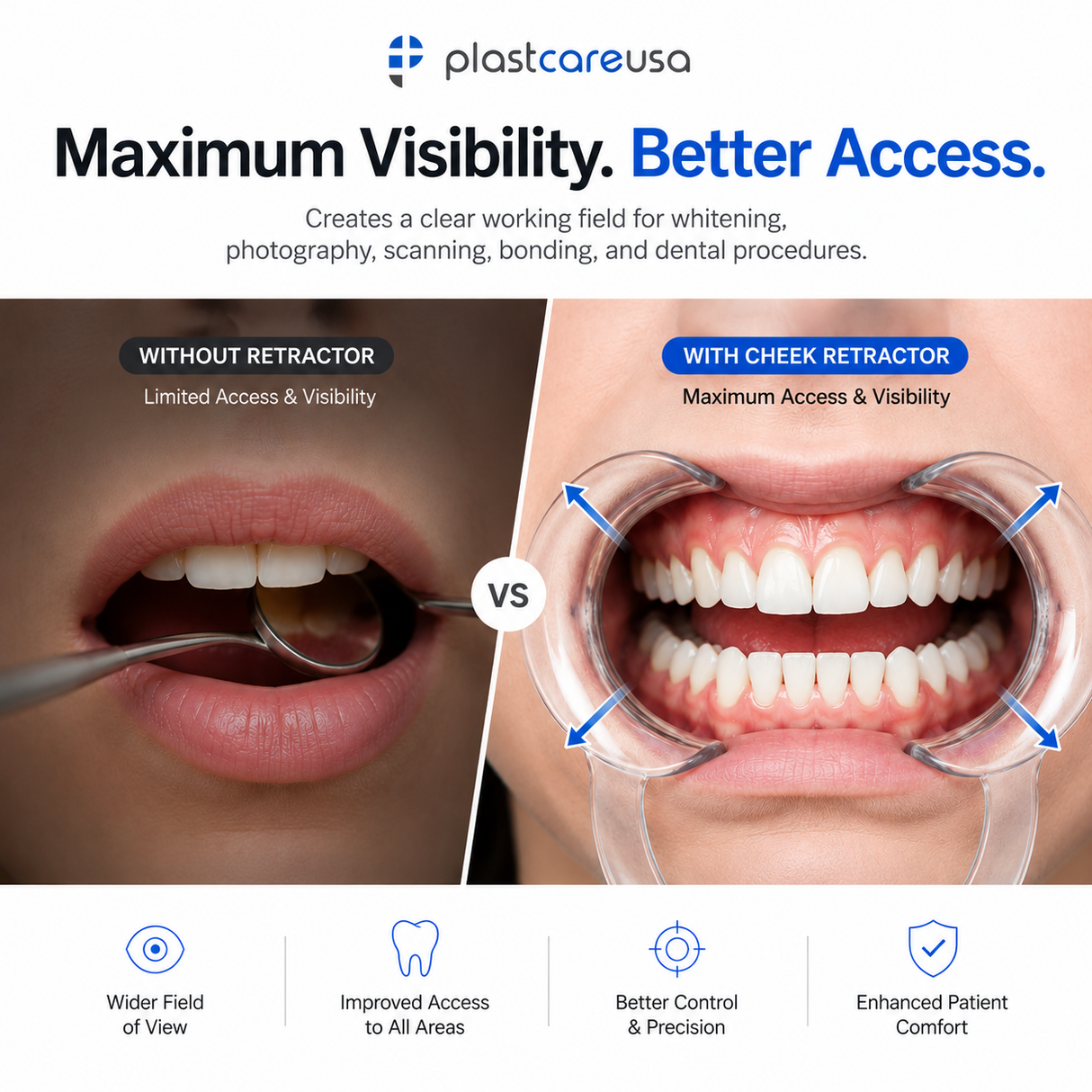 20 Small Cheek Mouth Dental Retractors - Premium Quality for Optimal Dental Procedures