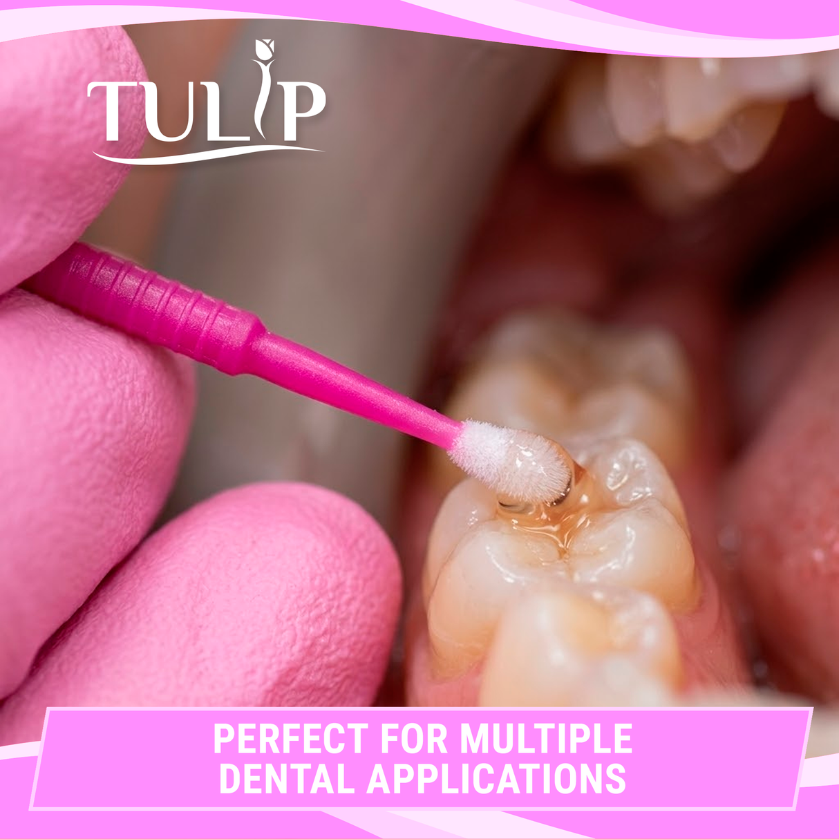 TULIP Fine Micro Applicator Brushes – Pink (1.5mm) | (4 kegs of 100) (400 Total)