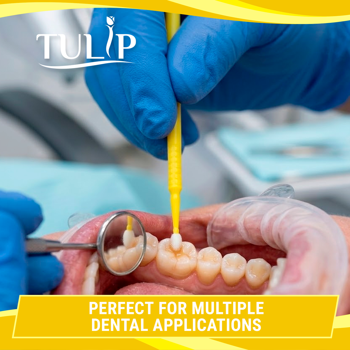 TULIP Fine Micro Applicator Brushes – Yellow (1.5mm) | (4 kegs of 100) (400 Total)