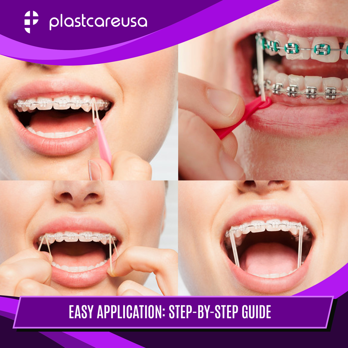 2000 (3/16" Rabbit, Heavy 6.5 Oz) Assorted Colors Orthodontic Latex Elastic Rubber Bands for Braces - My DDS Supply