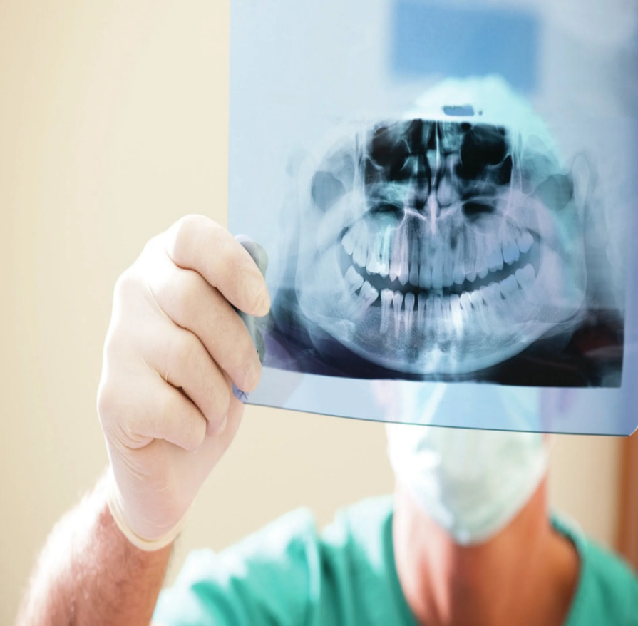 1000 Small Latex Medical Examination Gloves Advance IF62 – Powder-Free, Textured, White