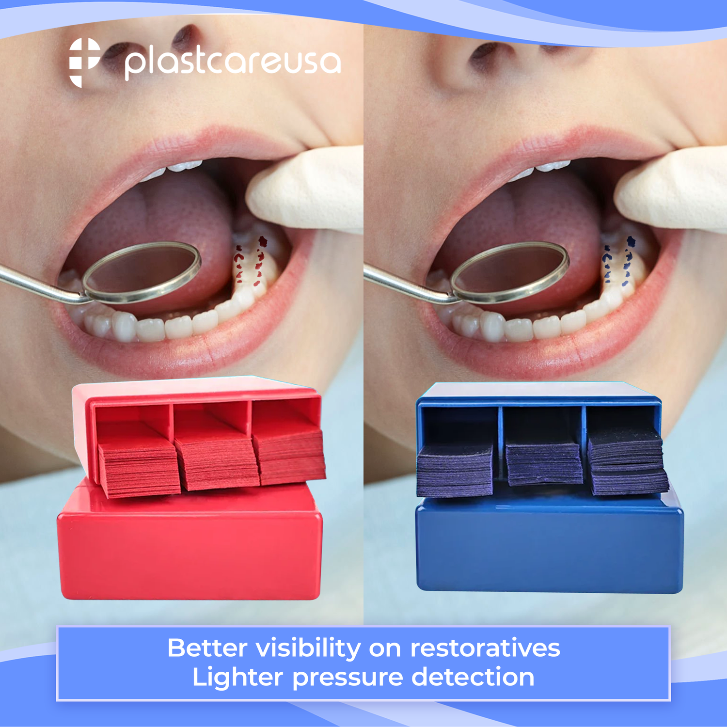 Blue Articulating Paper – 55×18mm, 100 Micron Dental Occlusion Strips (300 Sheets)