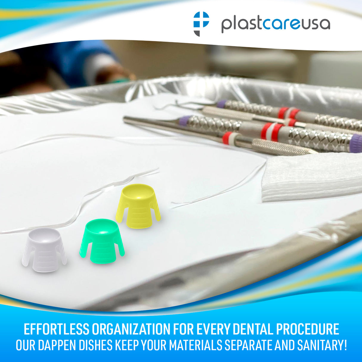 200 Assorted Disposable Small Plastic Dappen Dish Containers – Liquid Bowls for Dental and Nail