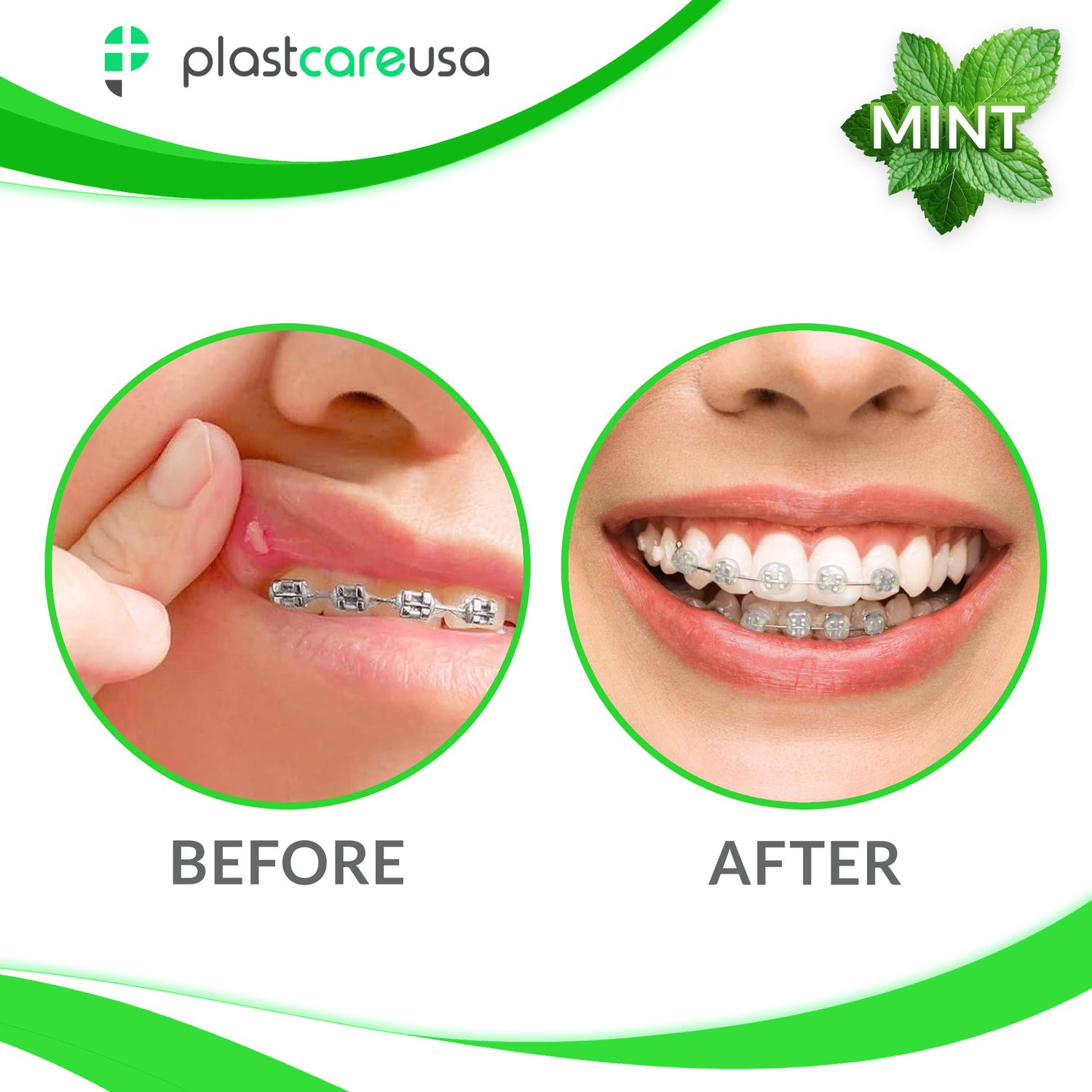 Mint Braces Dental Wax (Pack of 12 Boxes)