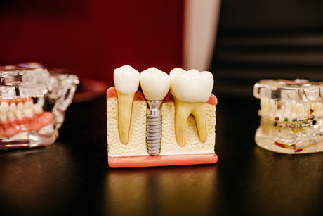 Common Alginate Impression Errors