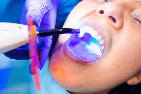 Hardening Smiles with Light: The Role of Dental Curing Lights in Modern Dentistry