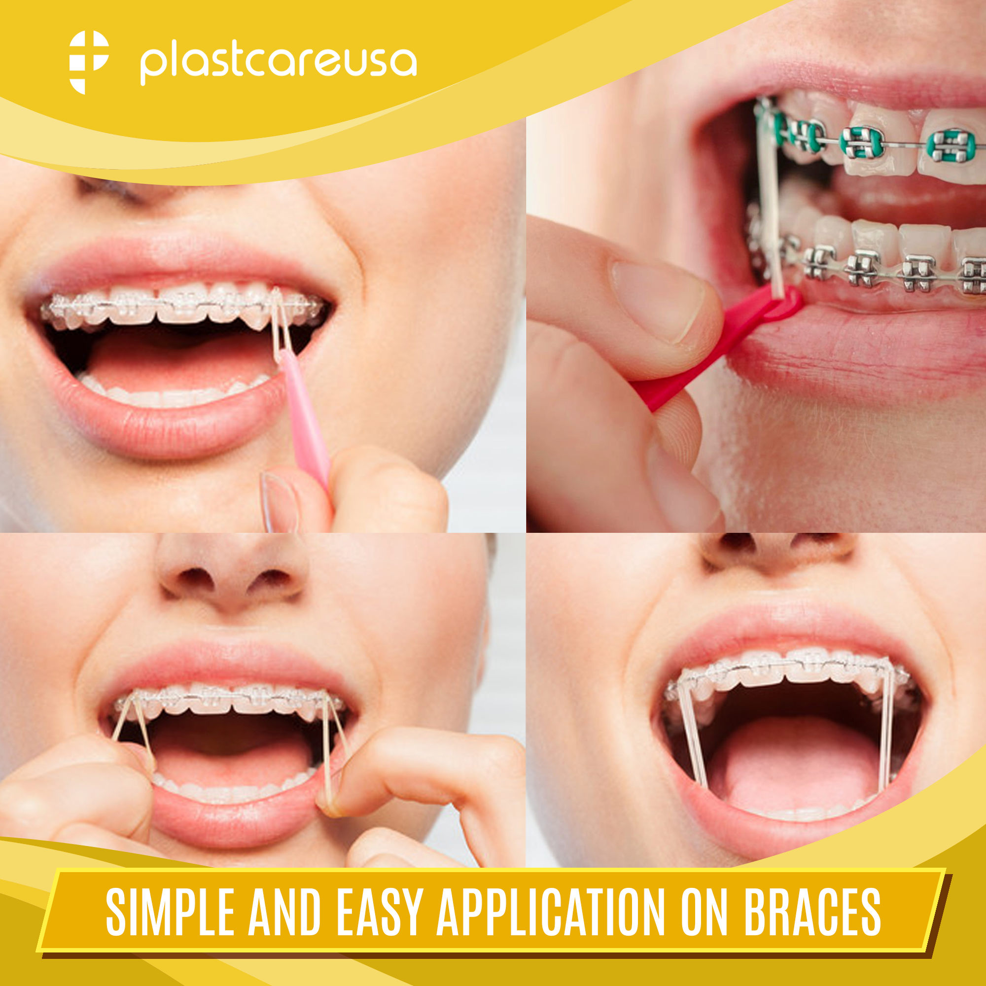 15 Size Dental Orthodontic Elastics Kit – 5000pcs Latex Rubber Bands For Braces, Orthodontics, USA Seller