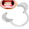 Medium Cheek Mouth Dental Retractors (Bag of 20) - My DDS Supply