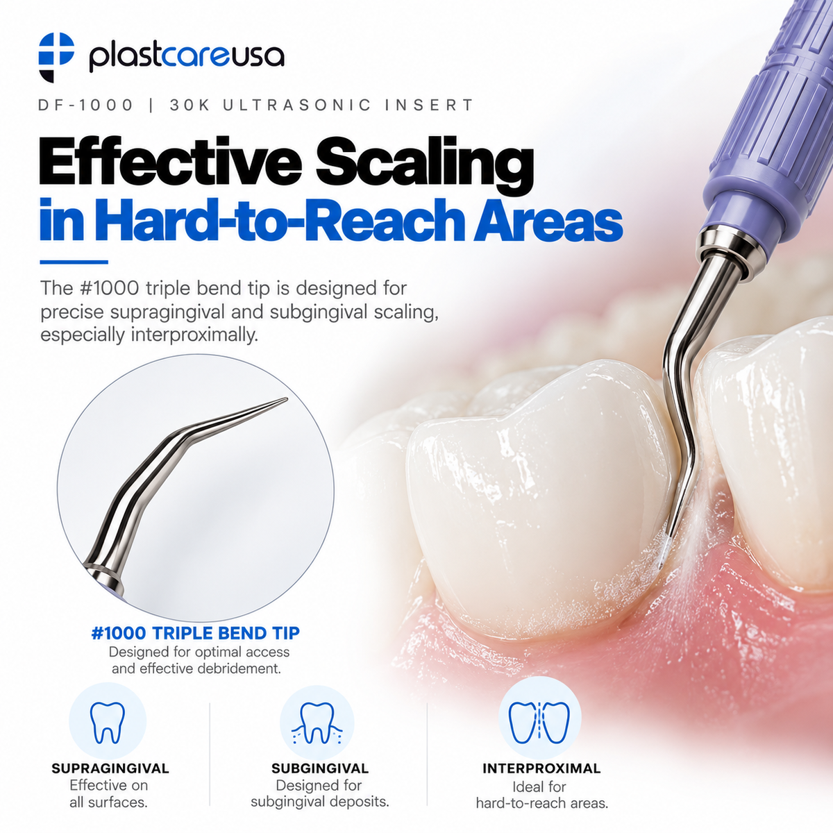 30K Ultrasonic Scaler Insert – DF-1000 Triple Bend, Internal Water Flow