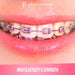 1040 Pink Dental Ligature Rubber Ties Bands Braces Orthodontic Elastic, 1 Bag - My DDS Supply